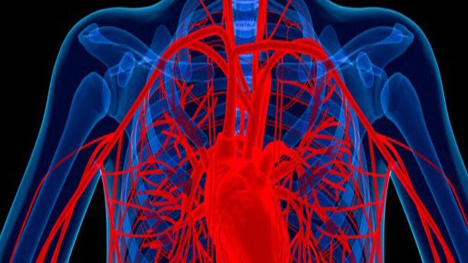 Aort anevrizması nedir?