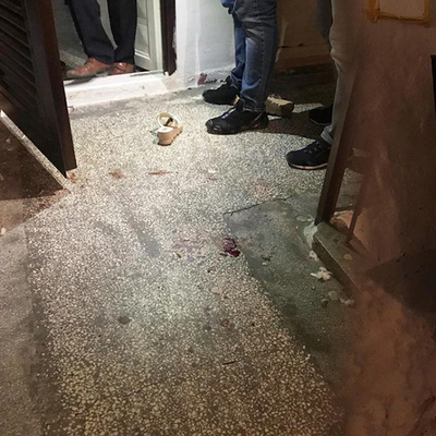 Kapı dürbününden baktı, dehşeti yaşadı