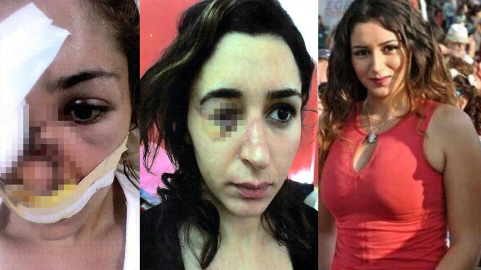 Yüzünü parçaladı, zorla evlendi! Tuğçe'nin kabusu bitmedi