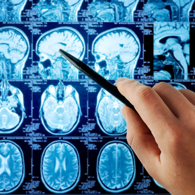 En çok korkulan hastalıklardan biri!