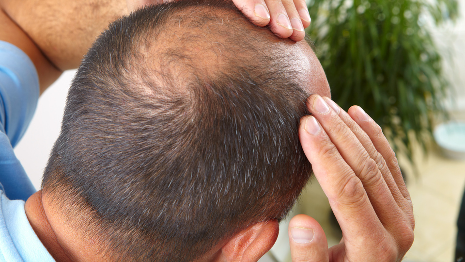 Kellik tarih mi oluyor?