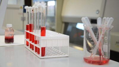 Sağlık ocağı tahlil sonuçları nasıl öğrenilir?