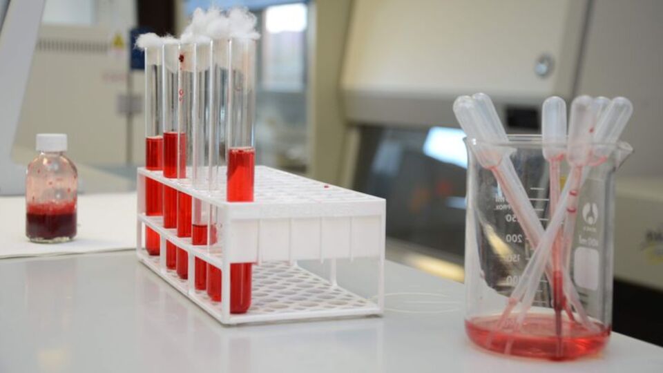 Sağlık ocağı tahlil sonuçları nasıl öğrenilir?