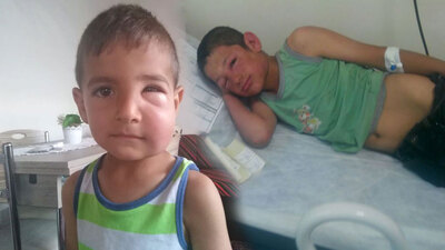 Çocuklar bu hale geldi, köylüler tarlaya gitmeye korkuyor