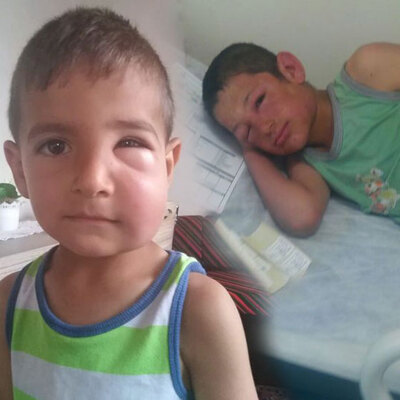 Çocuklar bu hale geldi, köylüler tarlaya gitmeye korkuyor