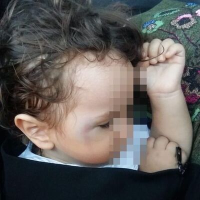 Ankara'da bebeğe yumruk!