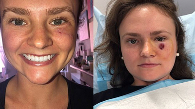 Sivilce sandı umursamadı! Hayatının şokunu yaşadı