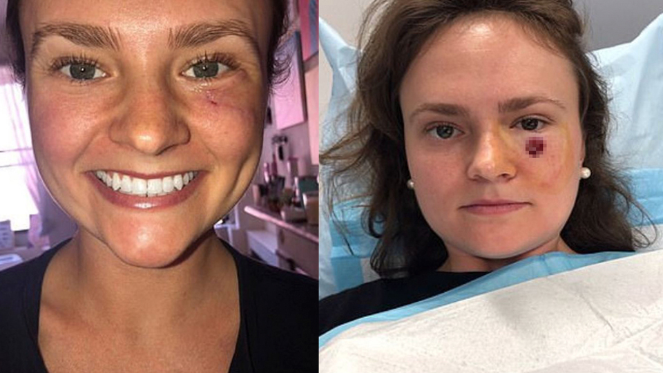 Sivilce sandı umursamadı! Hayatının şokunu yaşadı