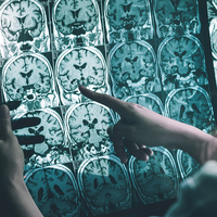 Çağın en korkulan hastalıklarından biri!