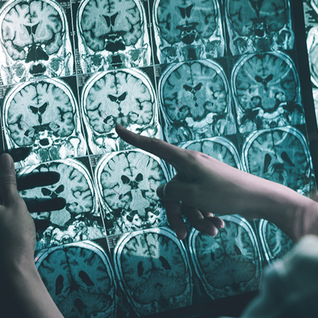 Çağın en korkulan hastalıklarından biri!