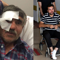 Kurban bayramında 'Acil'e gitmemek için bu önerilere dikkat!