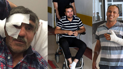 Kurban bayramında 'Acil'e gitmemek için bu önerilere dikkat!