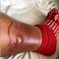 Balık tutmaya gitti hayatı kabusa döndü!