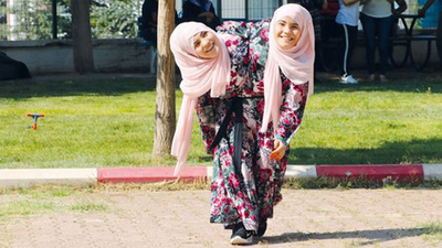 Siyam ikizlerinin hayali gerçek mi oluyor?