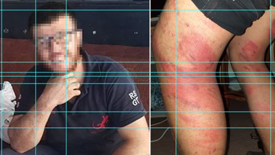 Kan donduran dehşet! Triger kayışı ile dehşet!