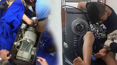 Elini kaptırdı, böyle getirildi