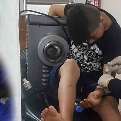 Elini kaptırdı, böyle getirildi