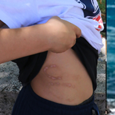 Çocuğa kan donduran işkence! Öğretmen anne ve sevgilisi tutuklandı