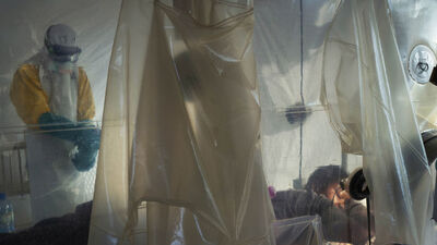 Ve başarı sağlandı! O hastalık tarih oluyor