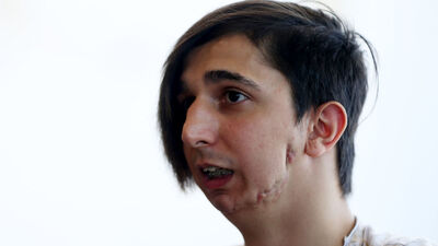 'Günde iki paket çekirdek çitliyorum'