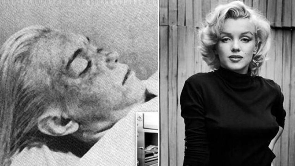 Morgda çıplak fotoğrafları çekilmiş!