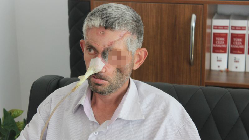 Dişini çektirmeye gitti kör oldu!