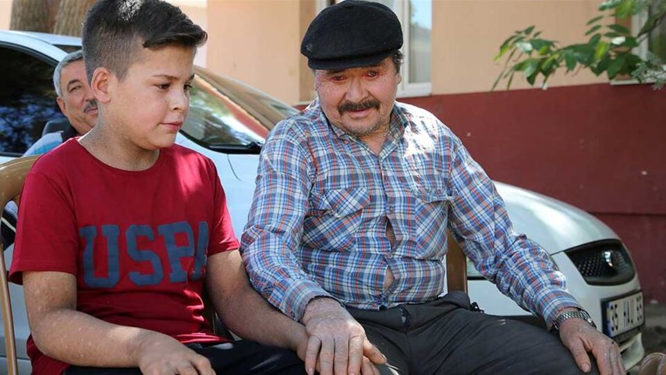 'Balık pulu' hastası 150 kişi rahatça dışarı çıkmak istiyor