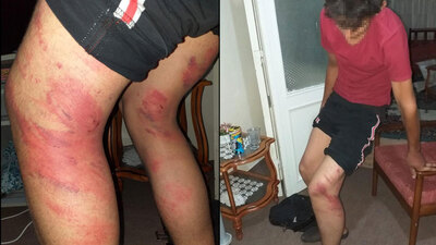 Konya'da 15 yaşındaki çırağa feci dayak: "Vurma diye yalvardım ama durmadı"