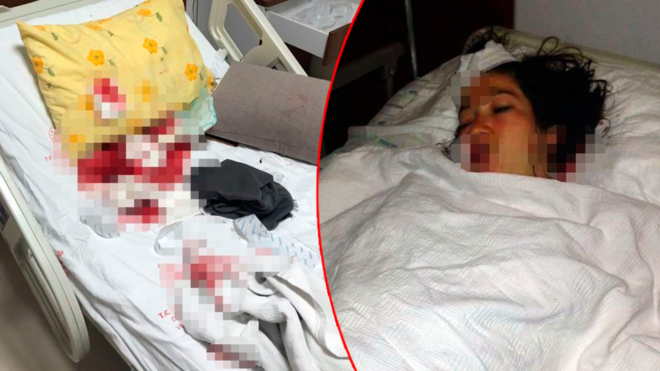 Doğum yapan eşini hastanede bıçakladı!