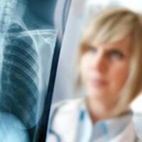 Akciğer kanseri belirtileri nelerdir?