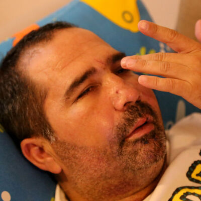 Park terörü hastanelik etti