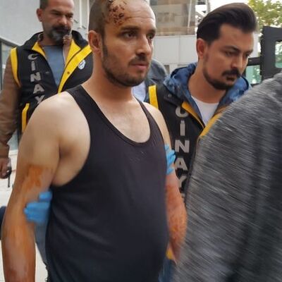 Sevgilisini yakmadan önce 79 kez aramış