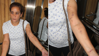 Sevgilisi feci biçimde darp etti!