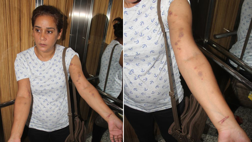 Sevgilisi feci biçimde darp etti!