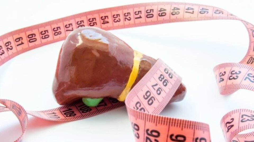 Karaciğer yağlanmasına ne iyi gelir?