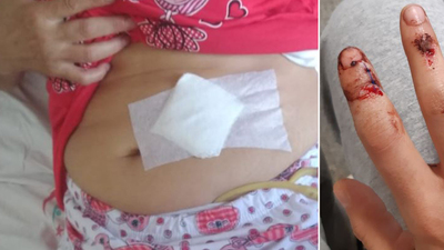 "Babam annemi hastanenin acilinde bıçakladı!"