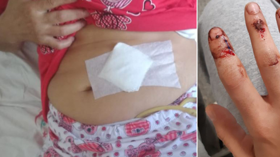 "Babam annemi hastanenin acilinde bıçakladı!"