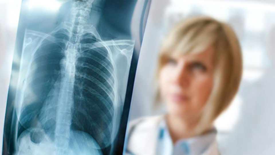 Zatürre nasıl tedavi edilir?