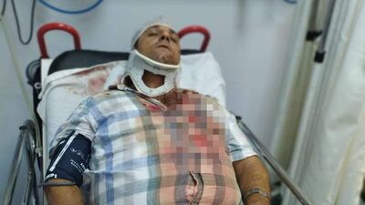 Servis şoförüne feci dayak! Okul yönetimi ile veliler anlaşamayınca olan ona oldu