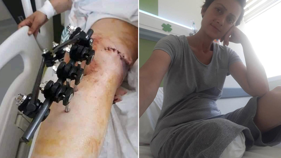 Eşinin vurduğu kadının bacağını kestiler!