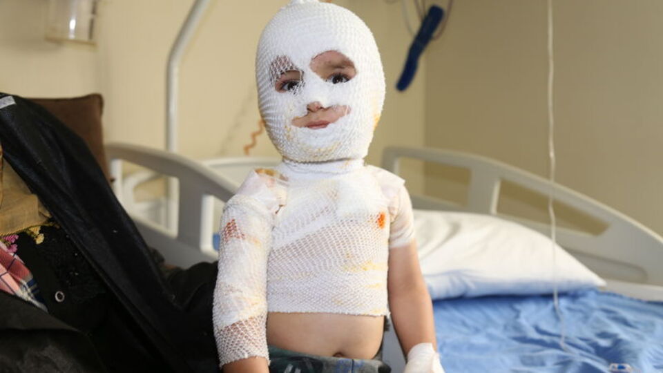 2 yaşındaki Yunus ölümden döndü!