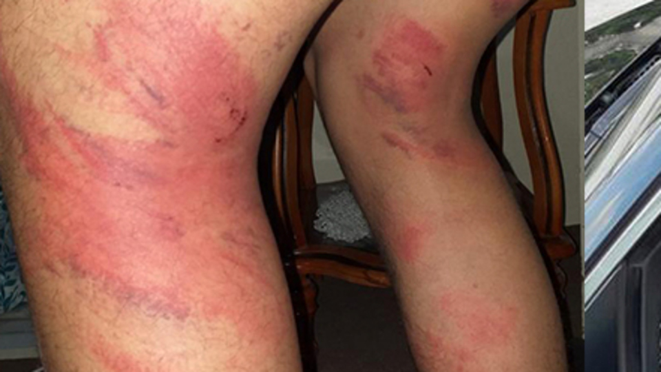 Çırağını döven ustayla ilgili gelişme!