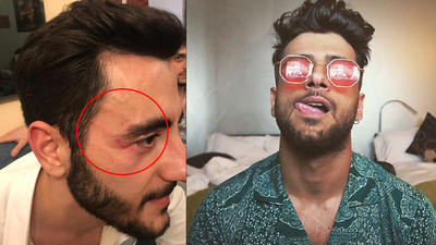 SHOW TV muhabiri Akif Yaman'a saldıran Reynmen kimdir?