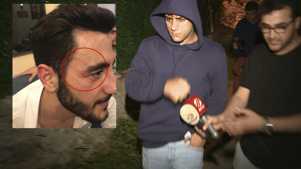 Reynmen gazetecilere saldırdı!