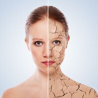 Cilt lekeleri için peeling