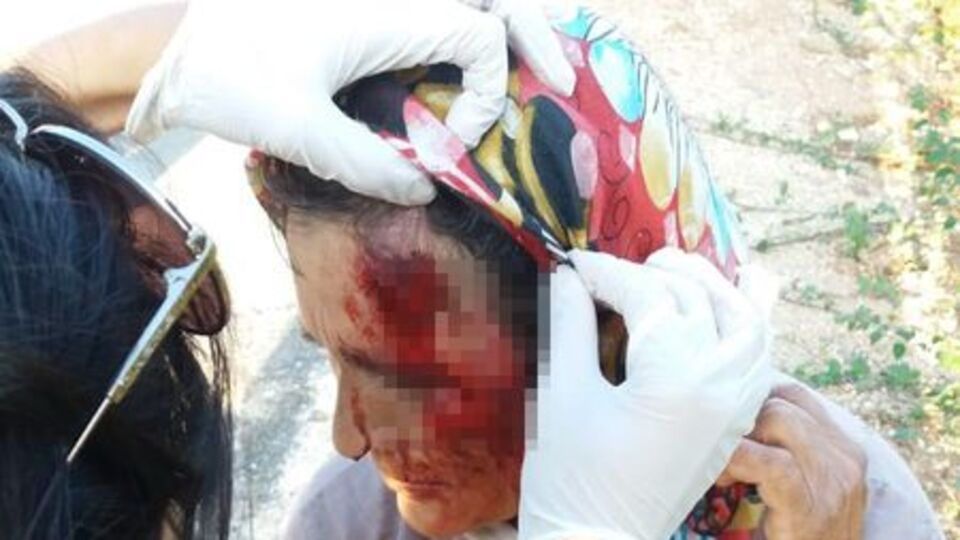 Yıllardır besliyor, bu hale getirdi