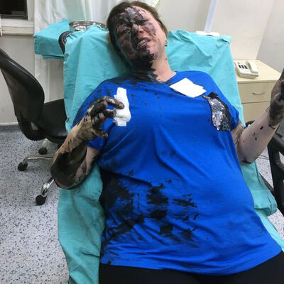 Genç kadını darp edip üzerine siyah sıvı döktüler!