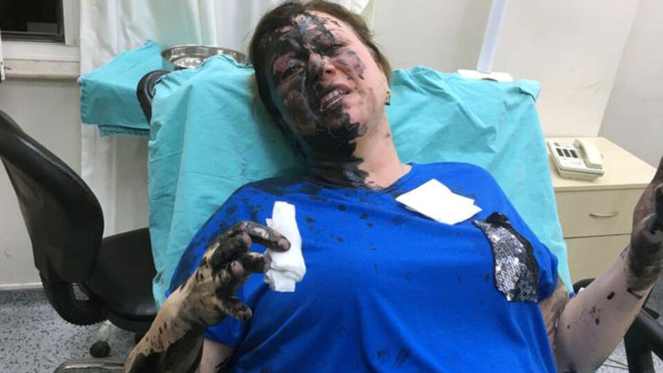 Genç kadını darp edip üzerine siyah sıvı döktüler!