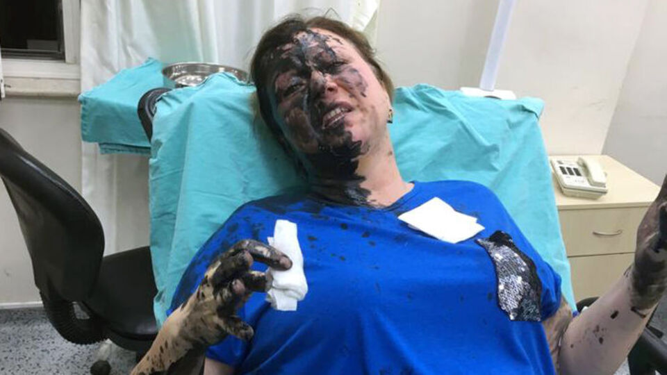 İş kadınını bu hale getiren zanlılarla ilgili şok gelişme