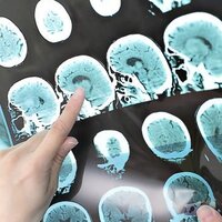 Korkunç! 2050 yılında 150 milyona ulaşacak!